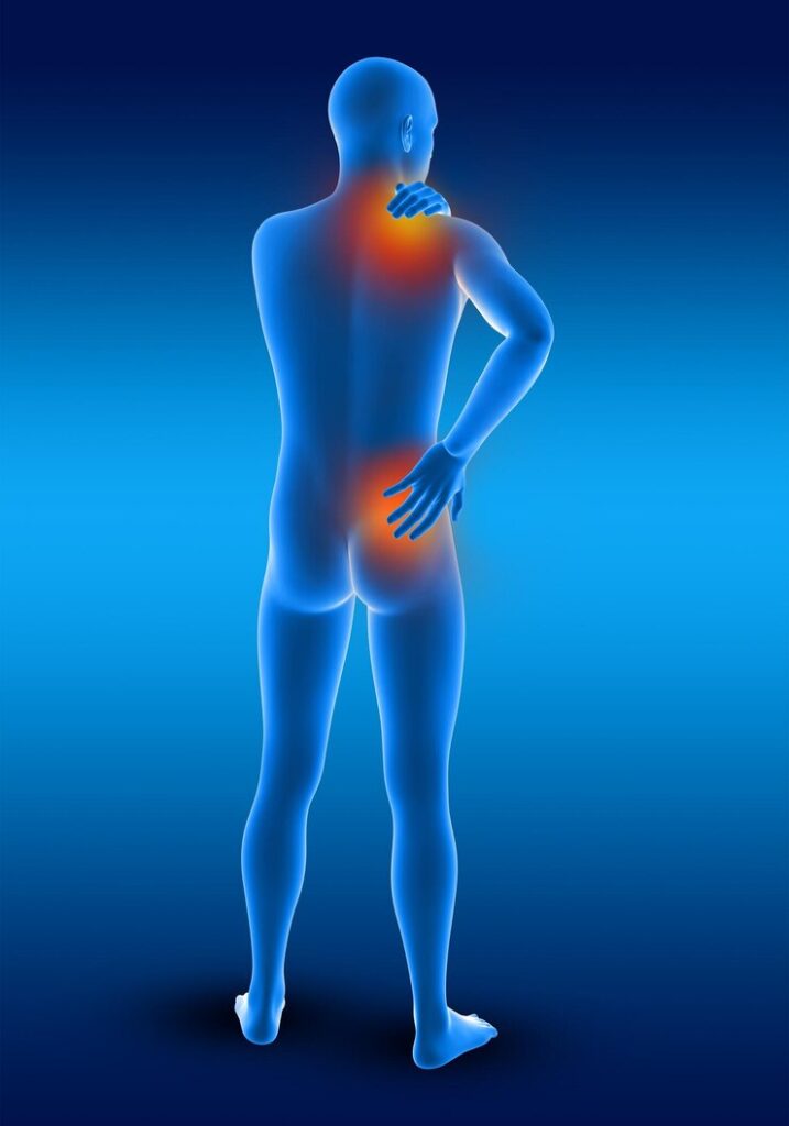 My Journey Using CBD for Arthritis Relief