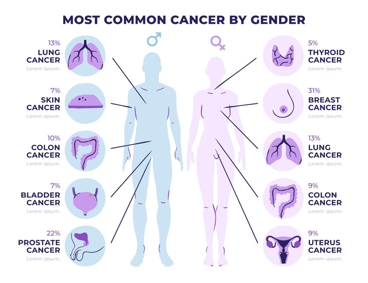 Current Studies on CBD and Different Types of Cancer