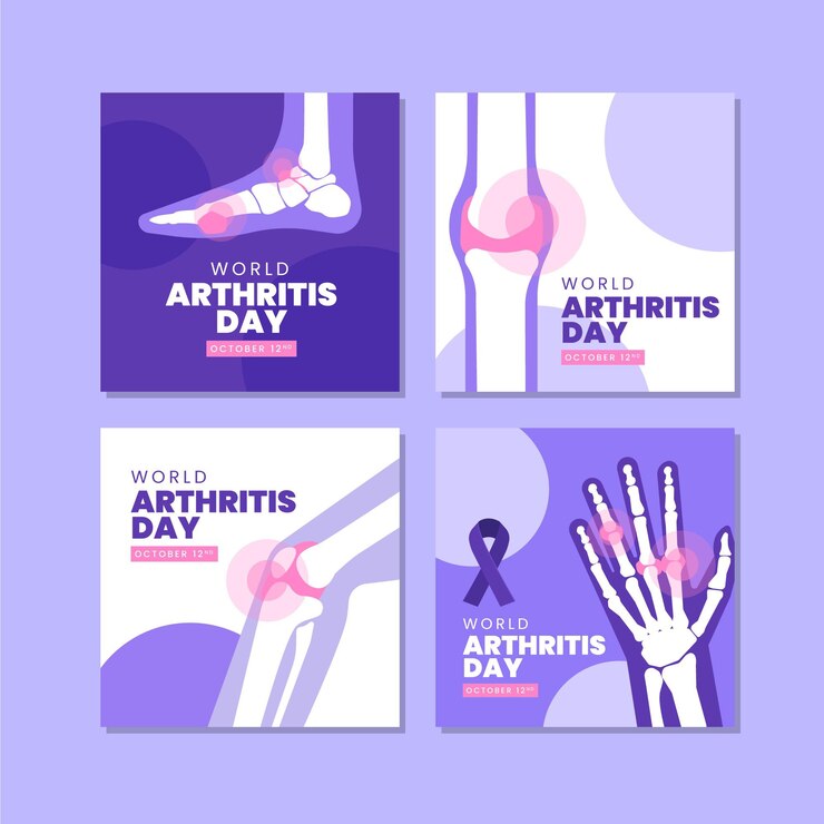 CBD for Arthritis: Can it Ease Joint Pain?