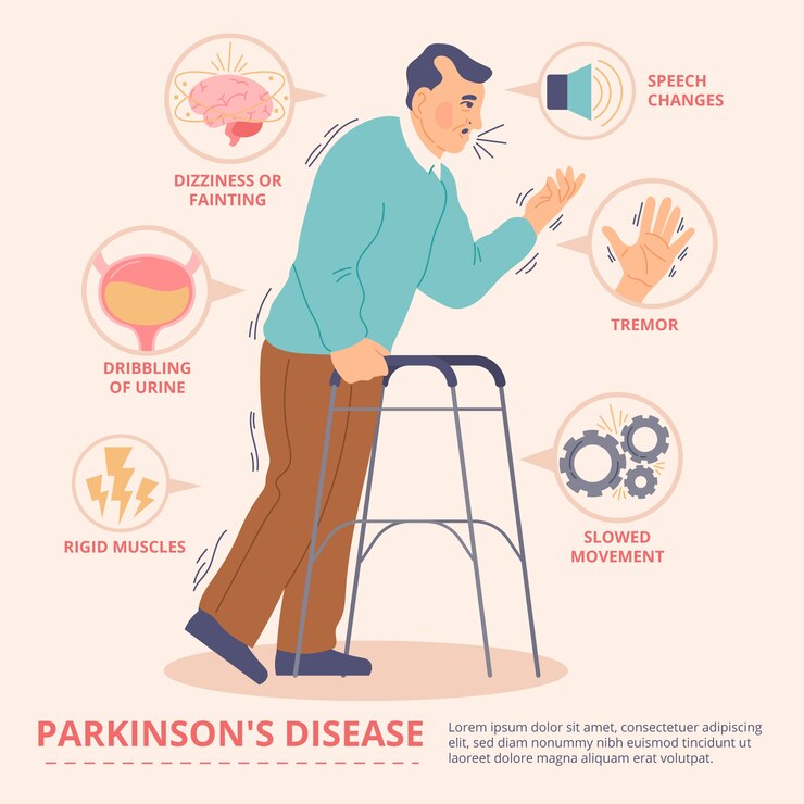 CBD for Parkinson's Disease: Exploring Potential Benefits