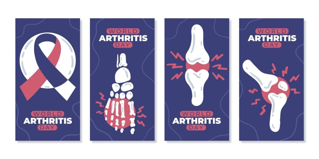 CBD for Bone Health: Promoting Growth and Preventing Loss