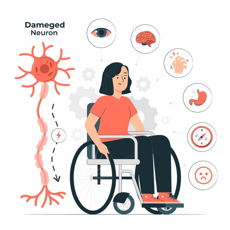 CBD for Multiple Sclerosis (MS): Symptom Management