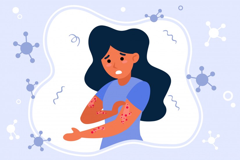 Can CBD Help Reduce the Need for Anti-Inflammatory Drugs?